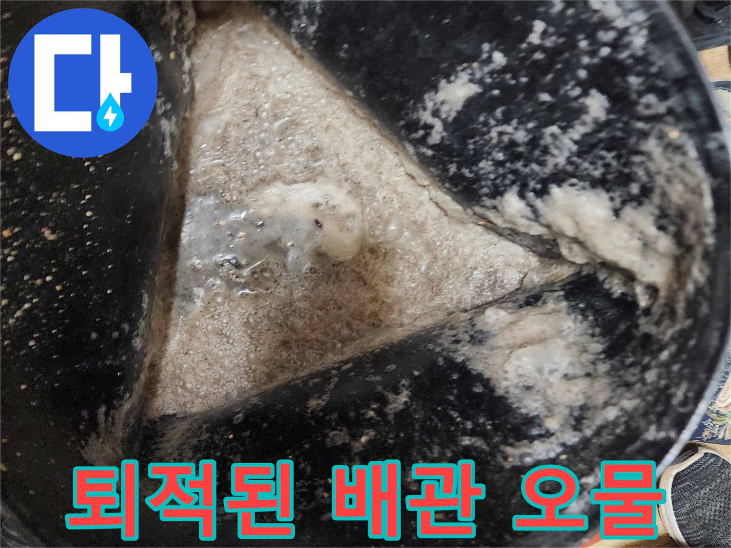 배출된 이물질로 가득 찬 용기 사진